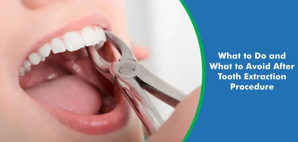 Tooth Extraction Procedure