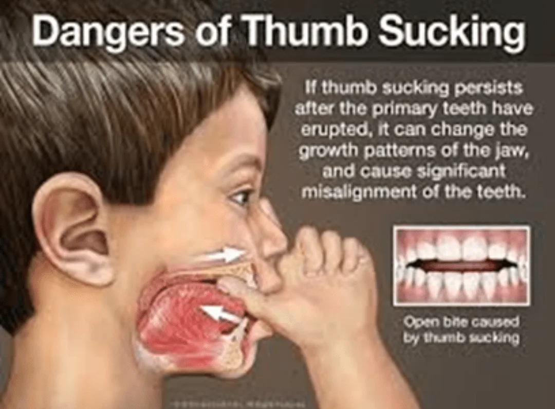 UNDERSTANDING PHASE1 ORTHODONTIC TREATMENT