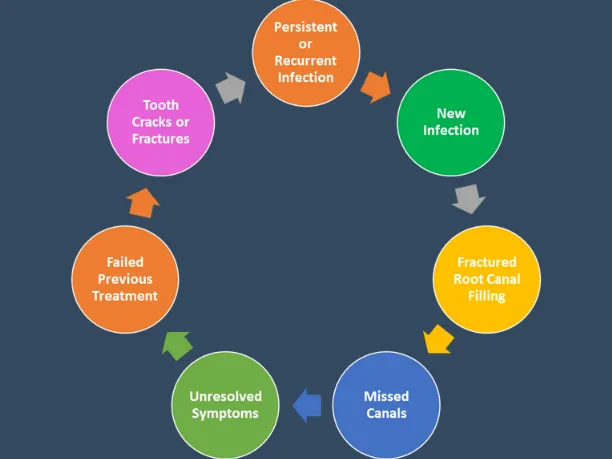 Indications for Re-Root Canal Treatment