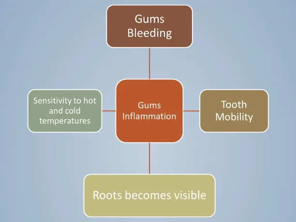 Understanding Receding Gums: Symptoms and Treatment Options