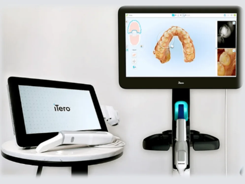 Digital Scanner In Dentistry